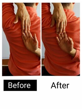 アース エンジェル整体院/ビフォアフ 肩甲骨はがし