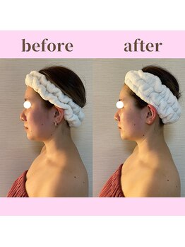 ココ(COCO)/お客様ビフォーアフター