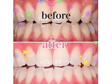 ダイヤモンドビューティー(DIAMOND BEAUTY)/一回でこの白さ！