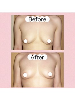 アップオー 小倉店(up・O)/体験者様　施術例