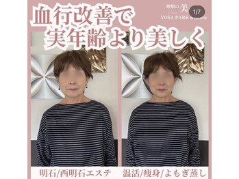 ヨサパーク レナータ(YOSA PARK Renata)/水素酸素吸入30分の変化♪