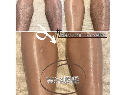 アエラ(AERA)の写真
