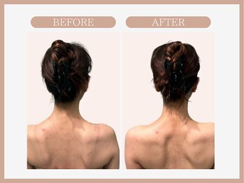 アコガレコガオ 盛岡店/