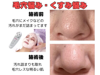 ブーケの写真