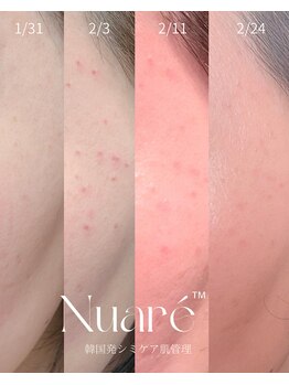 エリア(area.)/17、【韓国発シミケア Nuare】