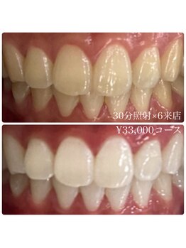 ホワイトニングルーム 横浜店(Whitening Room)/セルフホワイトニング/横浜
