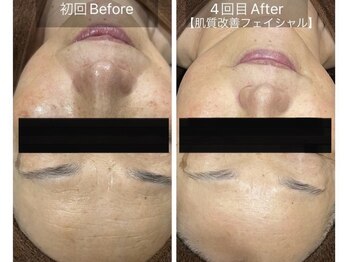 ケイ(Kei)の写真/お肌が変ると印象が変わる!くすみ、肌トラブル知らずの明るいお肌へ生まれ変わる