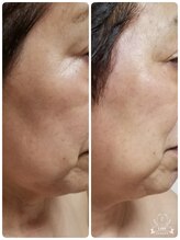 キレイとケンコウの応援サロン杉山/クイックリフト