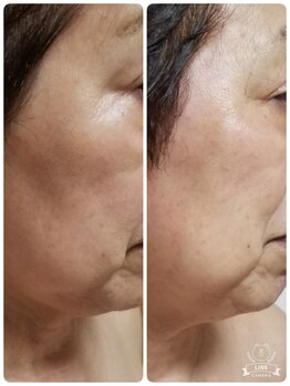 キレイとケンコウの応援サロン杉山/クイックリフト