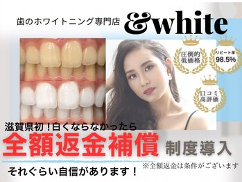 アンドホワイト(&white)