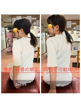 カルラ(KARURA)/回旋の可動域UP車のバックも楽々