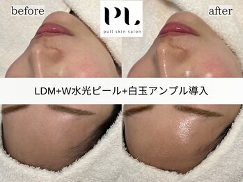 プル スキンサロン(pull skin salon)/