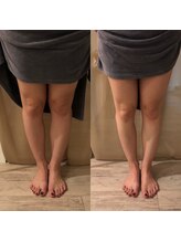 ニューミー スパ(newme spa)/むくんだ足も美脚へ！