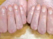 ポドネイル(PODO NAIL)