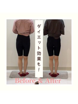 スタイルラボ高松/産後の骨盤矯正の効果♪