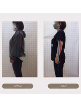 かがわ接骨院 高松伏石院/姿勢の悪さでお悩みの方！