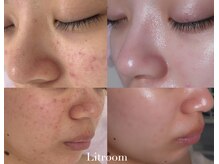 リトルーム(Litroom: from Seoul)/１年間の変化