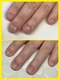 サンセリテ 用賀中町店(SINCERITE)の写真/【深爪や巻き爪でお悩みの方へ】人に見せるのが恥ずかしい爪を卒業しませんか