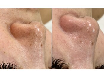 トータルビューティーサロン ナーズ(NAZ)/