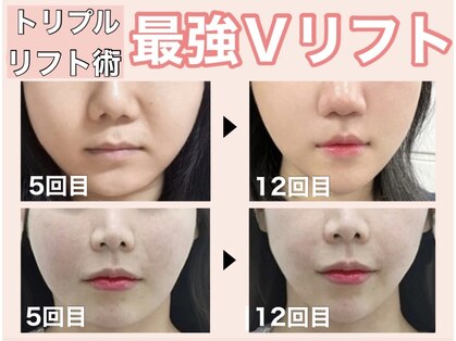 ゴールデンケア(goldencare)の写真