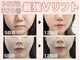 ゴールデンケア(goldencare)の写真