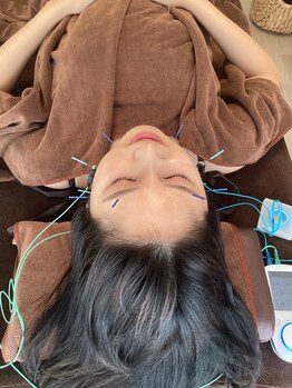 ハリファ鍼灸院 横浜関内院(HariFa鍼灸院)/美容施術