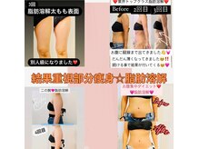 レアティ(Leathy)の雰囲気（部分の痩せが叶う☆結果重視痩身☆お腹/二の腕/太もも/腰回り/顔）