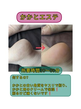 スノードロップ(snowdrop)/かかとエステ +1,000