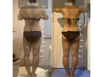 ティラ(Tira)の写真/薄着シーズン到来！バザルトストーン・若よもぎ蒸しで深部を温め巡らせる◎整うボディラインケア♪