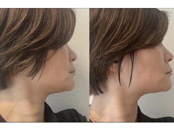 ヨサパーク こらっしぇ御徒町店(YOSA PARK)/水素まみれコースが大人気