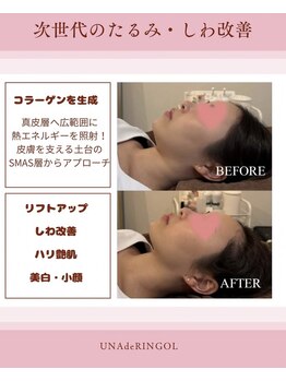 ウナ デ リンゴル 恵比寿店(UNA de Ringol)/