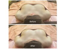 ベンザイ 梅田店(BENZAI)/バスト離れ、下垂、バストUP