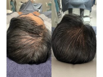 タリア(TALIA)/髪の毛のお悩みもお任せ！