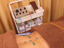 リライフ鍼灸整骨院 新橋院の雰囲気(鍼灸施術できます!お顔の鍼灸も大歓迎♪むくみ知らずの小顔に◎)