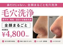 ハーシークレット(Her secret)