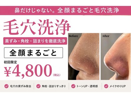 ハーシークレット(Her secret)の写真