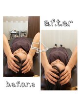 アンドユー カゴシマ(&you kagoshima)/頭蓋調整