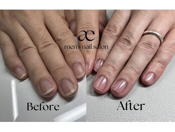 アッシュ(ash)/スタンダードコース