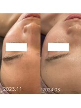 ルシェリア(Le cherien)/継続でちゅる艶肌