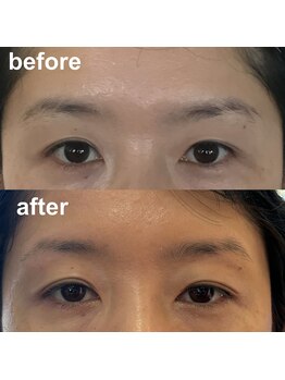 リマ(Lima)/アイブロウモデル