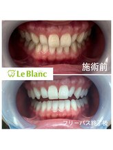 ルブラン 奈良店(Le Blanc)/写真でも映える歯に♪