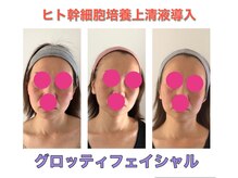 クラ接骨院(KURA接骨院)/きれい肌へ