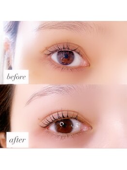 ルファナ(Lufana)/ラッシュリフト