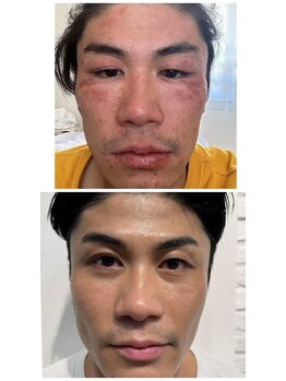 ブリエ(Brille)/男性にも人気ダイヤモンドピール