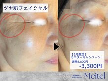 めいてる
