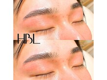 シュエール(Chuaile)/メンズハリウッドブロウリフト