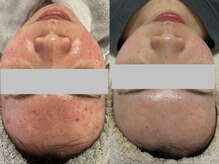 イーサロン(eii salon)/20代女性