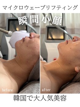 リリー(LILY)/韓国美容 LILY