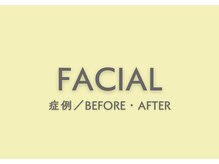 モカラ(MOKARA)/【美容】フェイシャルエステ多数