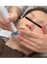 エヌフェイシャル(N.facial)/全顔Hgピーリング
